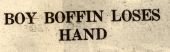 Boy boffin loses hand