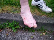 Alan Doran's toes... soon to be featured in a horror film